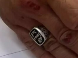 A ring worn by a man from East Jerusalem with the Seal of Muhammad on it, an inscription declaring "Muhammad is God’s messenger. He was arrested and put in detention by the police on suspicion that the ring expressed identification with the ISIS terror organization, although a district court judge dismissed the allegation. (Courtesy)