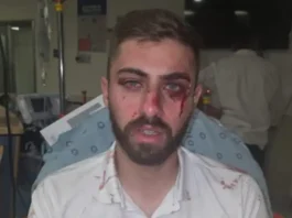Ahmad Shehadeh seen recovering in hospital after brutal assault while driving his bus route in Jerusalem on July 15, 2025